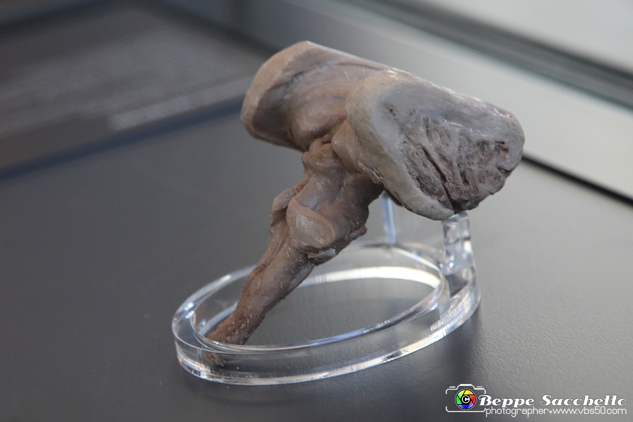 VBS_3000 - Tronco cerebrale - Mostra Body Worlds.jpg